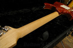 0223_TomAn_neck.jpg